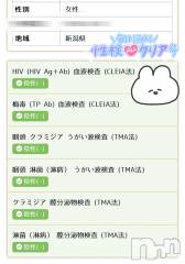 新潟デリヘル新潟の可憐な妻たち～秘密の逢瀬～(ニイガタノカレンナツマタチ～ヒミツノオウセ～) 黒江 しずく(33)の3月12日写メブログ「今日あつそう՞ ՞ ՞」
