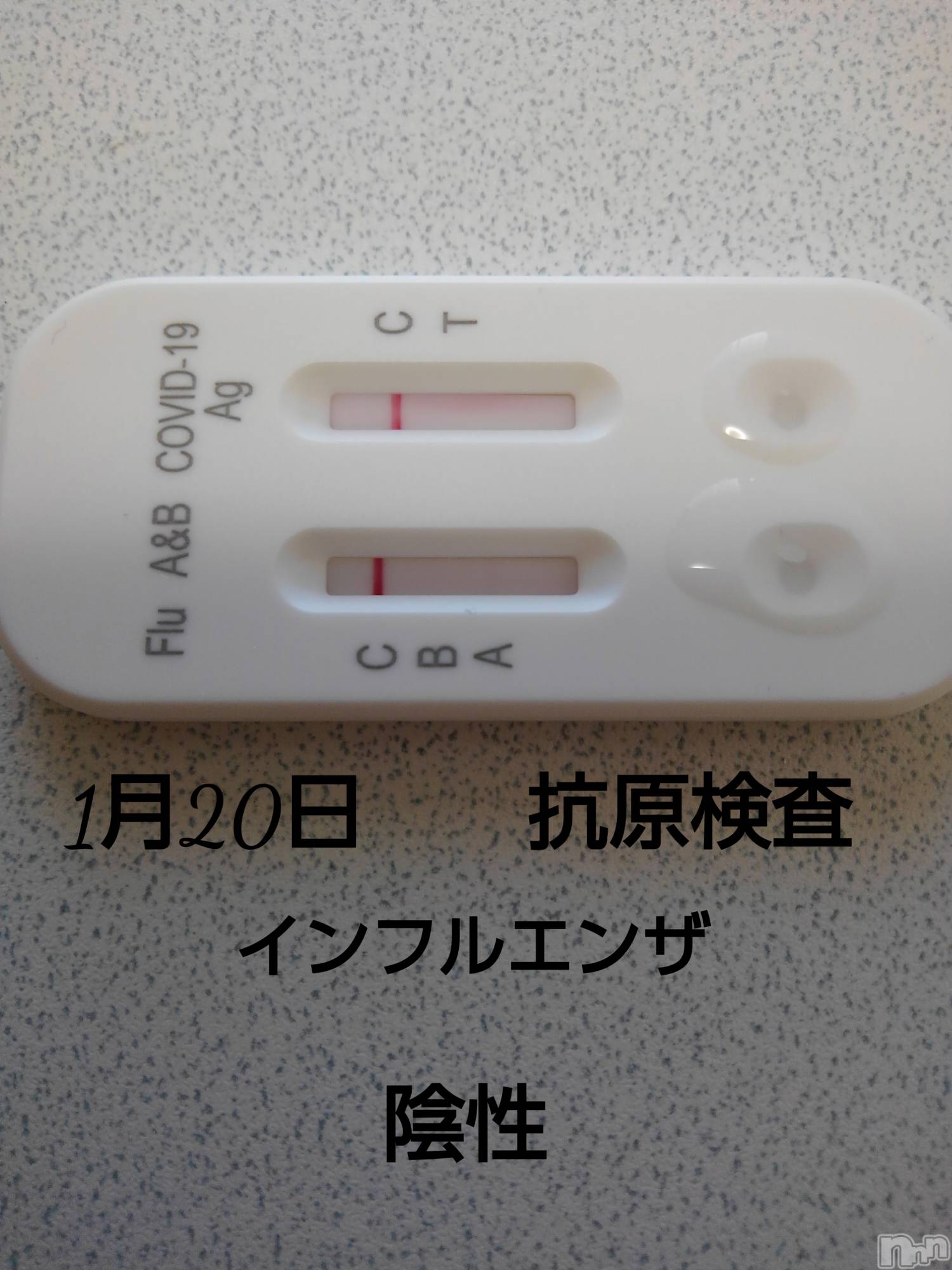 上田発人妻デリヘル人妻華道 上田店(ヒトヅマハナミチウエダテン)【熟女】あきこ(56)の2023年1月20日写メブログ「検査(^_^)v」