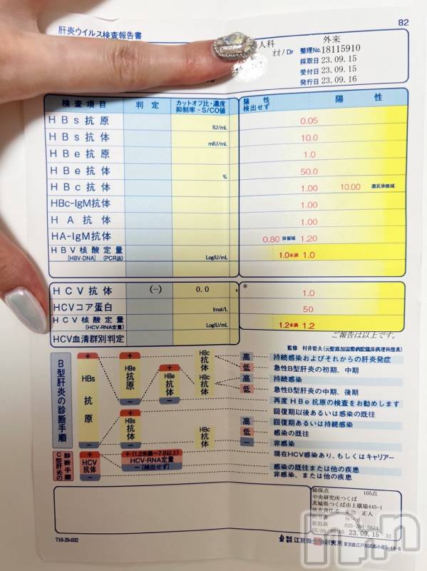 新潟デリヘルA(エース)まいか(A)(20)の2023年9月19日写メブログ「前の日記の続きです😓(画像が見にくかったので二つに分けました」