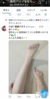 Xデー