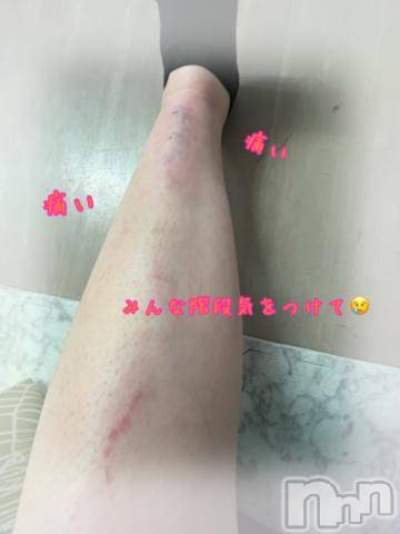 新潟デリヘル奥様特急 新潟店(オクサマトッキュウニイガタテン)へきる(22)の2023年11月20日写メブログ「怪我したけど会いにきて😢」