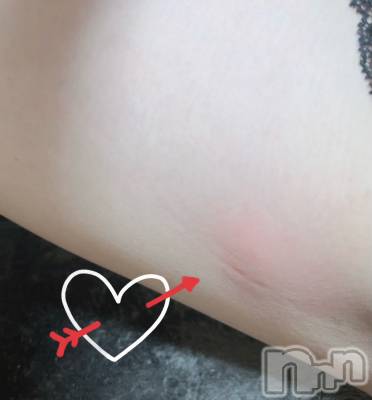 長岡デリヘル Mimi(ミミ) ひな★月間RANK1位★(25)の6月6日写メブログ「ふとももにきず🦟」