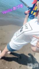 松本発デリヘルVANILLA(バニラ) あづき(41)の8月12日写メブログ「鍼灸とカッピングと透けさせたチクビ」