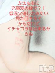新潟デリヘル新潟市鳥屋野潟ちゃんこ(ニイガタシトヤノガタチャンコ) まこ(45)の7月18日写メブログ「火傷？！」