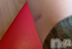 上越デリヘルHONEY(ハニー) みさき(♪)(47)の3月19日写メブログ「ケロイド治療」