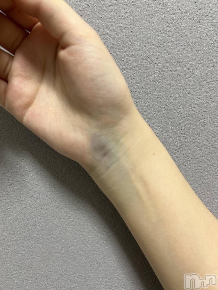 ����ȯ����ѥ˥��󥯥�ֿ��㥳��� -���㥳��ѥ˥��󥯥��-(�˥���������� -�˥���������ѥ˥��󥯥��-) ���ۡ������������3��15���̥�֥����ֿͤˤ�äƤ�����ʤ��Τ餻���⡩��