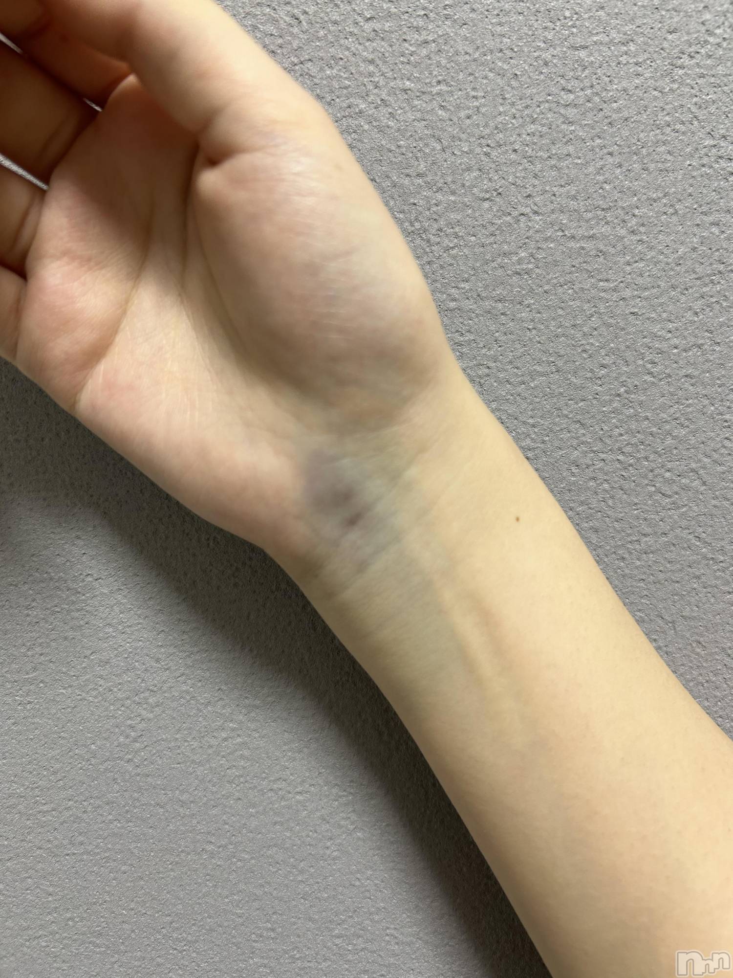 ����ȯ����ѥ˥��󥯥�ֿ��㥳��� -���㥳��ѥ˥��󥯥��-(�˥���������� -�˥���������ѥ˥��󥯥��-) ��2026ǯ3��15���̥�֥����ֿͤˤ�äƤ�����ʤ��Τ餻���⡩��