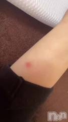 新潟メンズエステあろまえすて＠新潟(アロマエステアットニイガタ) 恋＊れん(28)の2月26日動画「プチッと火傷」