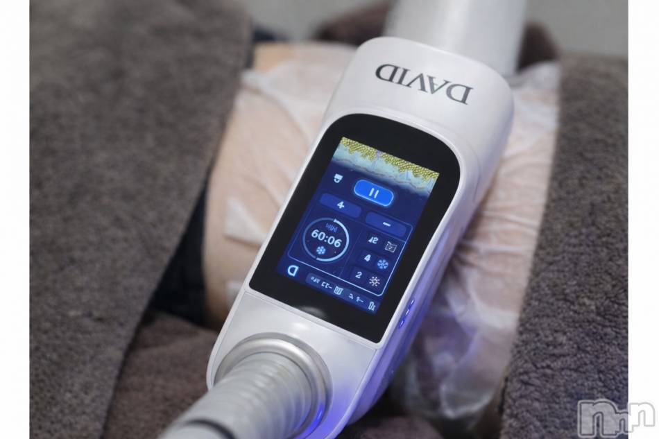 長岡メンズエステ(メンズケア ダヴィデ)の2026年4月10日お店速報「【men's Care DAVID】間もなく導入、脂肪冷却とは？」