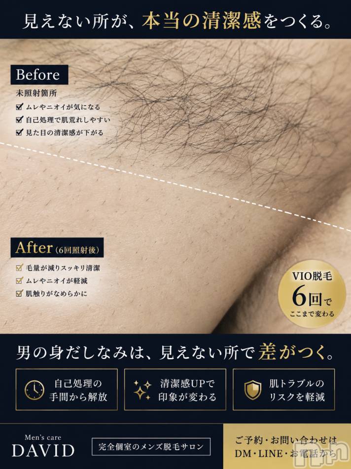 長岡メンズエステ(メンズケア ダヴィデ)の2026年7月26日お店速報「【DAVID】こんなに違うのっ👀!?✨」