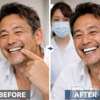 長岡メンズエステ Men's Care DAVID(メンズケア ダヴィデ)の3月5日お店速報「【men's Care DAVID】歯のホワイトニング始めました✨」