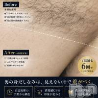 長岡メンズエステ Men's Care DAVID(メンズケア ダヴィデ)の7月26日お店速報「【DAVID】こんなに違うのっ👀!?✨」