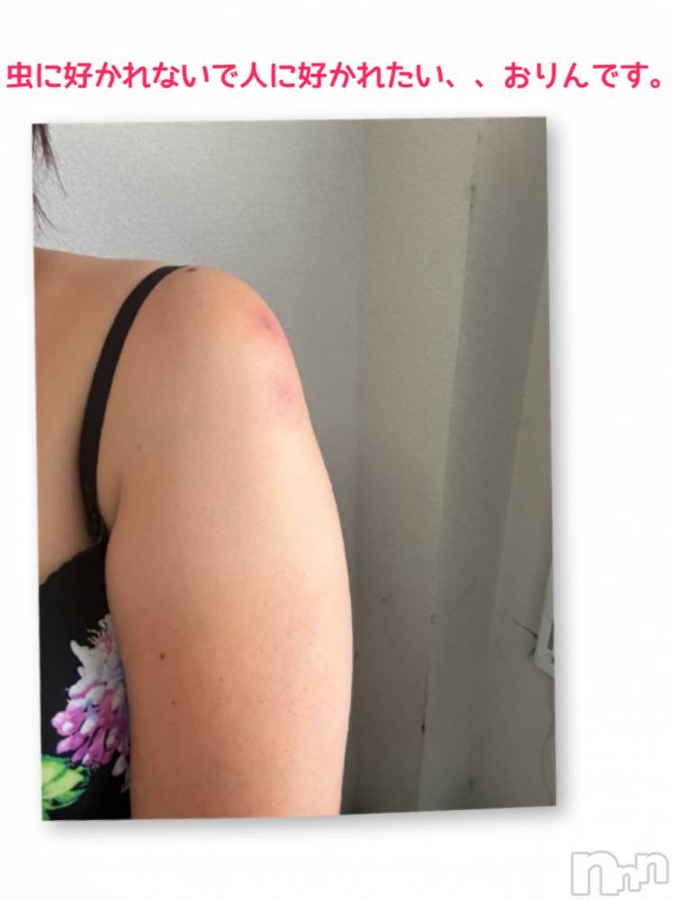 長野デリヘルStory ～人妻物語～(ストーリー) 極安☆おりん(44)の10月1日写メブログ「痒い、、、」