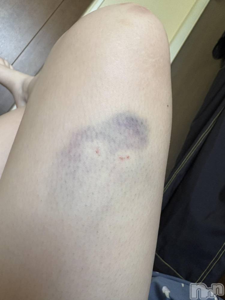 ��ˬ����Х��顦����֥���� �ץ���� ��ˬ(����� �ץ���� ����) ���� ����3��18���̥�֥�����😣💥��