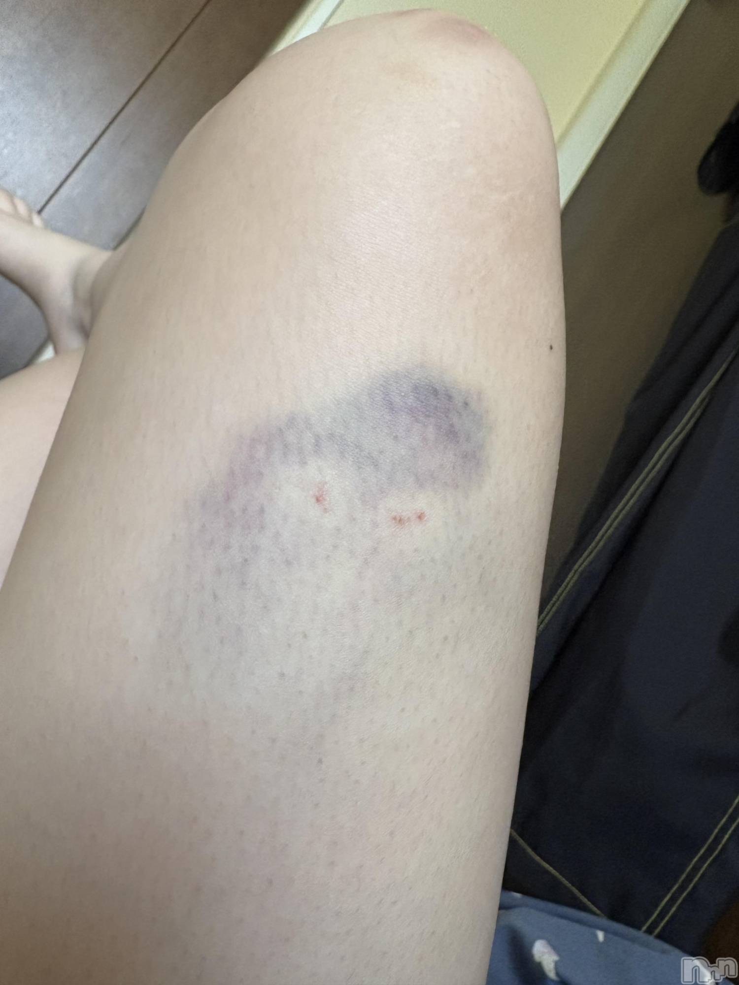 ��ˬ����Х��顦����֥���� �ץ���� ��ˬ(����� �ץ���� ����) ��2026ǯ3��18���̥�֥�����😣💥��