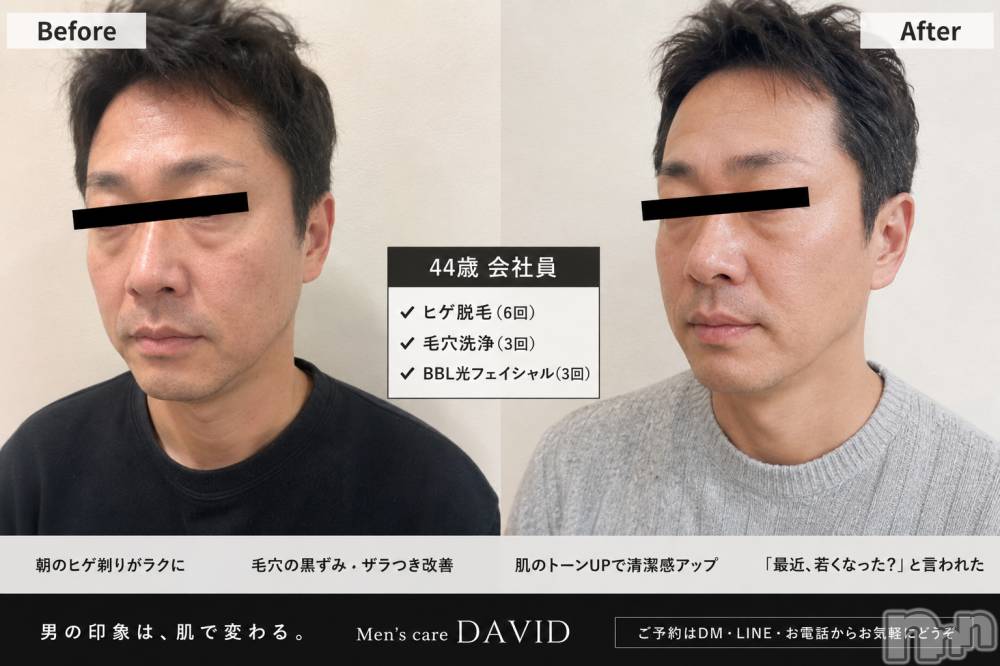 長岡メンズエステMen's Care DAVID(メンズケア ダヴィデ) MOEKAの7月22日写メブログ「へんしーん🤟❣️」