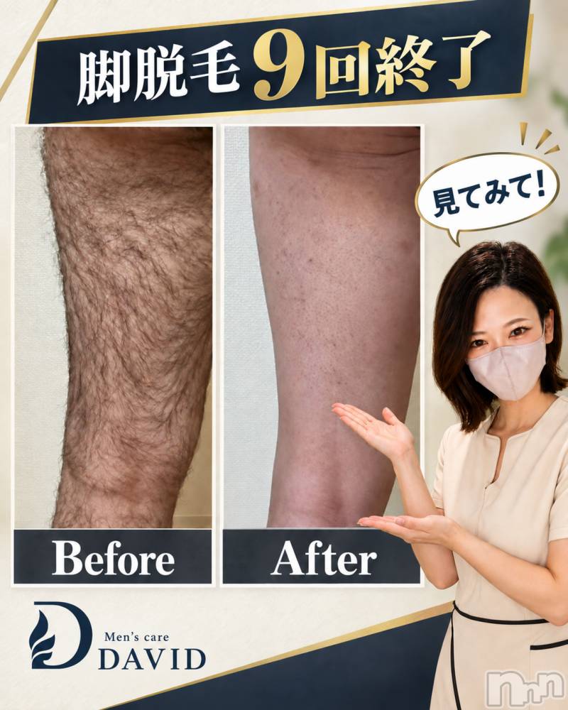 長岡メンズエステMen's Care DAVID(メンズケア ダヴィデ) MOEKAの9月19日写メブログ「見てください！！！✨」
