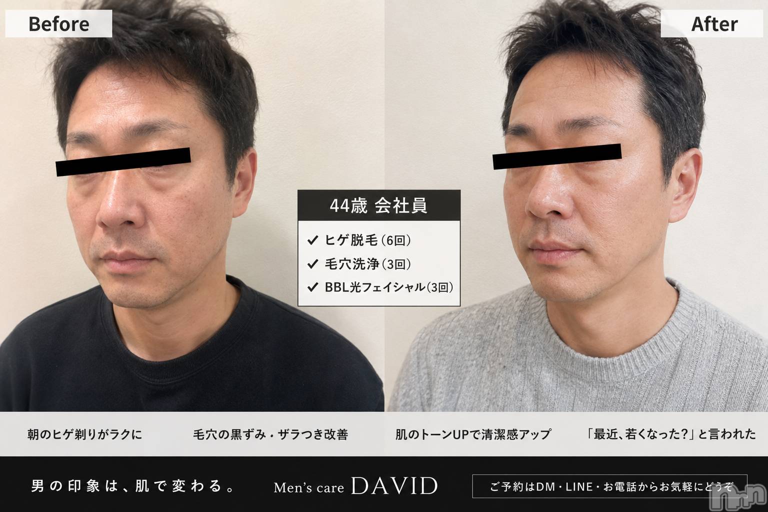 長岡メンズエステMen's Care DAVID(メンズケア ダヴィデ)MOEKAの2026年7月22日写メブログ「へんしーん🤟❣️」