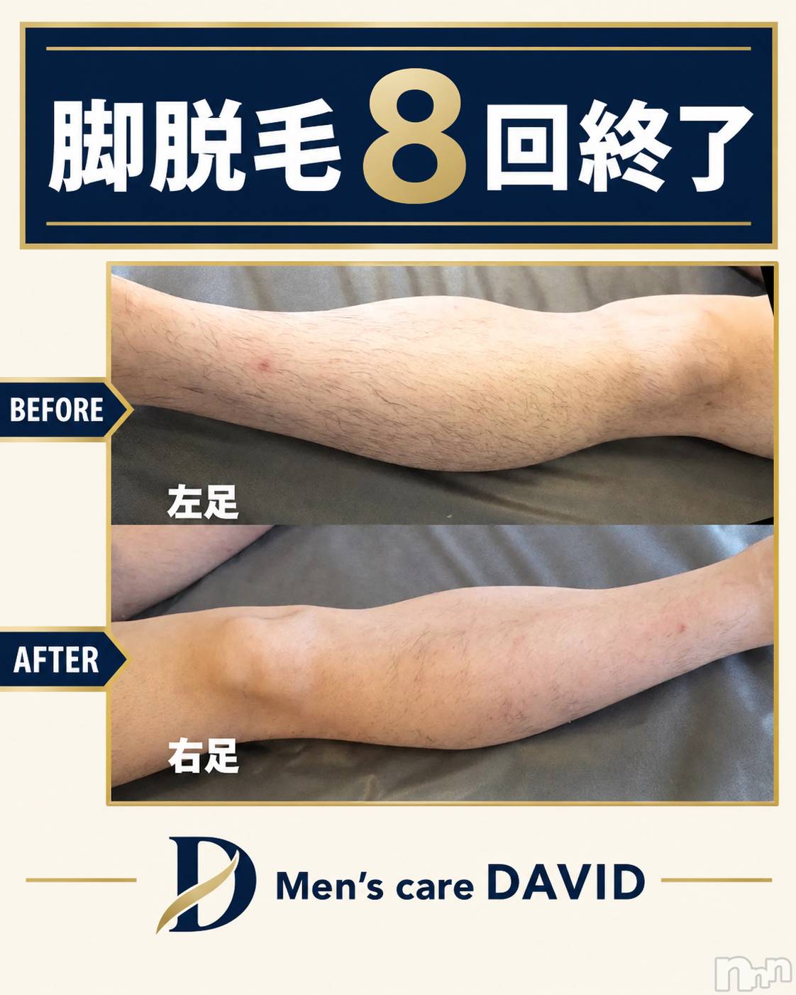 長岡メンズエステMen's Care DAVID(メンズケア ダヴィデ)MOEKAの2026年9月20日写メブログ「人気No.3・・・👏✨」