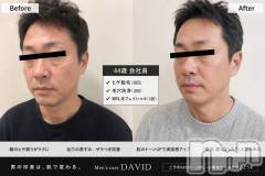 長岡メンズエステMen's Care DAVID(メンズケア ダヴィデ) MOEKAの7月22日写メブログ「へんしーん🤟❣️」
