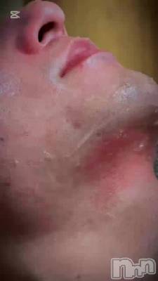 効果抜群髭脱毛