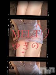 新潟デリヘルMelt(メルト) 【新人】ゆきの(27)の7月24日写メブログ「ゲリライベント開催中」