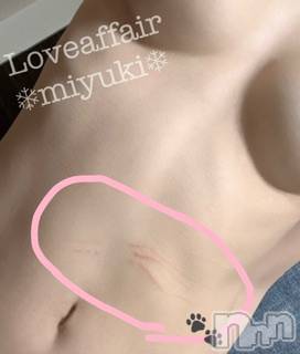 新潟デリヘルLOVE AFFAIR～秘密のデート(ラブアフェア～ヒミツノデート)美雪さん【♪♪♪】(35)の2026年4月23日写メブログ「お腹に三本の引っかき傷…！犯人は…」