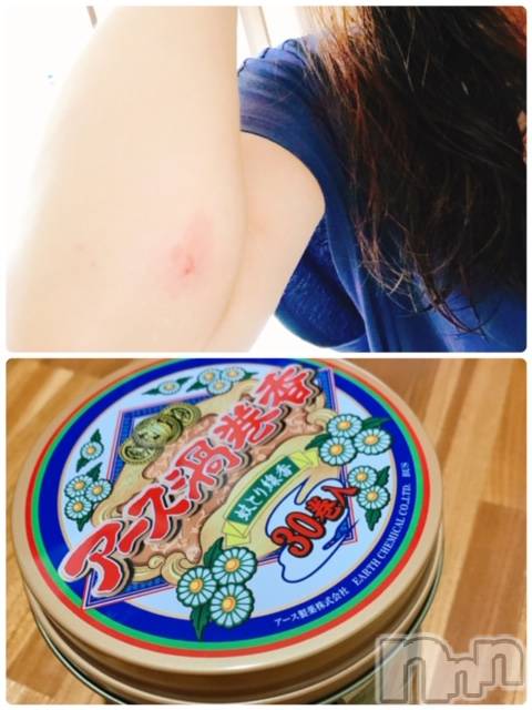 上越デリヘル上越風俗出張アロママッサージ(ジョウエツフウゾクシュッチョウアロママッサージ)ゆずき☆(37)の2020年7月1日写メブログ「虫刺されの季節になって☆」