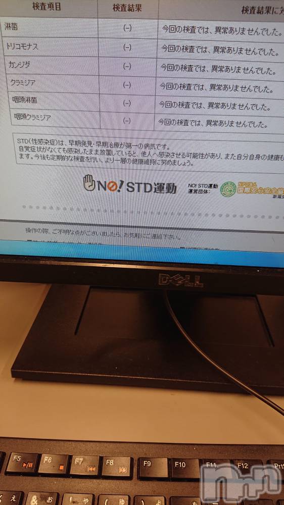 上越人妻デリヘルらぶ妻　～新潟の人妻が集う店～(ラブツマ) 【お得妻】渡辺かな★即尺◎(49)の7月4日写メブログ「SТD（性病検査）の結果」