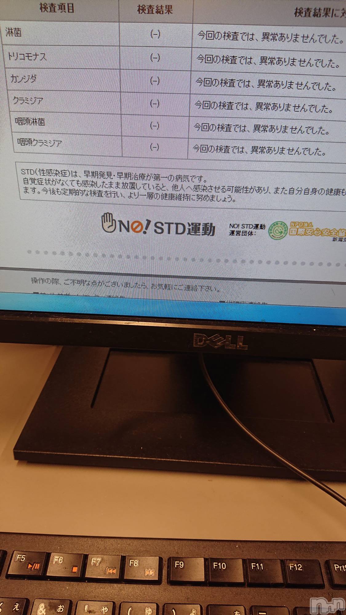 上越人妻デリヘルらぶ妻　～新潟の人妻が集う店～(ラブツマ)【お得妻】渡辺かな★即尺◎(49)の2019年7月4日写メブログ「SТD（性病検査）の結果」