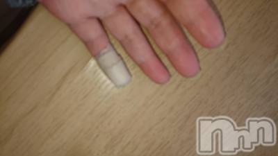 上越デリヘル らぶ妻　～新潟の人妻が集う店～(ラブツマ) 【お得妻】渡辺かな★即尺◎(49)の1月18日写メブログ「昨日の負傷した小指😅」