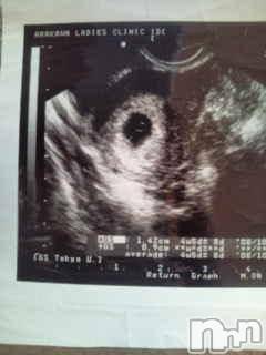 Ĺ襳ѥ˥󥯥ֻ򥳥ѥ˥󥯥 Amour(ࡼ) Ȥߥޥ(36)42̥֥֤朗()