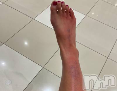 長岡デリヘル Mimi(ミミ) チョコ【SPアドバイザー】(24)の6月2日写メブログ「階段から落下した人←」