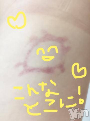 甲府ソープBARUBORA(バルボラ) こゆきの6月14日写メブログ「てんとう虫」